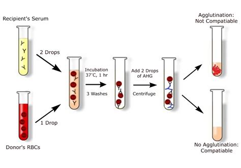 blood compatibility test with a drop of blood|Blood Typing and Crossmatching .